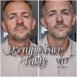 Read more about the article GLP-1 w praktyce: Ozempic, Munjaro i co TikTok nie mówi o terapii.